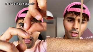 PULLING A HANGNAIL  Photography Tutorial in #Shorts by youneszarou