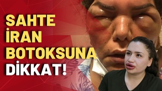 Sahte botoks skandalını Barış Pehlivan anlattı!