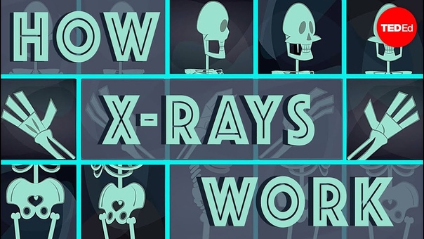 How X rays see through your skin Ge