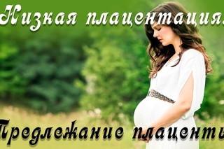 Дети Выживание вида. 26-серия. Низкая плацентация. Предлежание плаценты. Плацента при беременности.