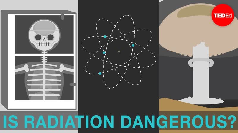 Is radiation dangerous Matt