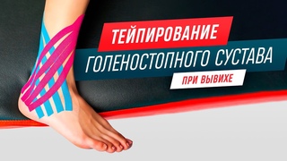 ПОДВЕРНУЛ НОГУ. ЧТО ДЕЛАТЬ ТЕЙПИРОВАНИЕ ГОЛЕНОСТОПНОГО СУСТАВА
