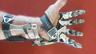 Fake Prosthetic Hand