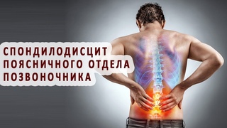 Что нужно знать о спондилодисците поясничного отдела позвоночника