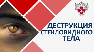 Деструкция стекловидного тела лечение. 👓 Лазерное лечение деструкции стекловидного тела. 12+