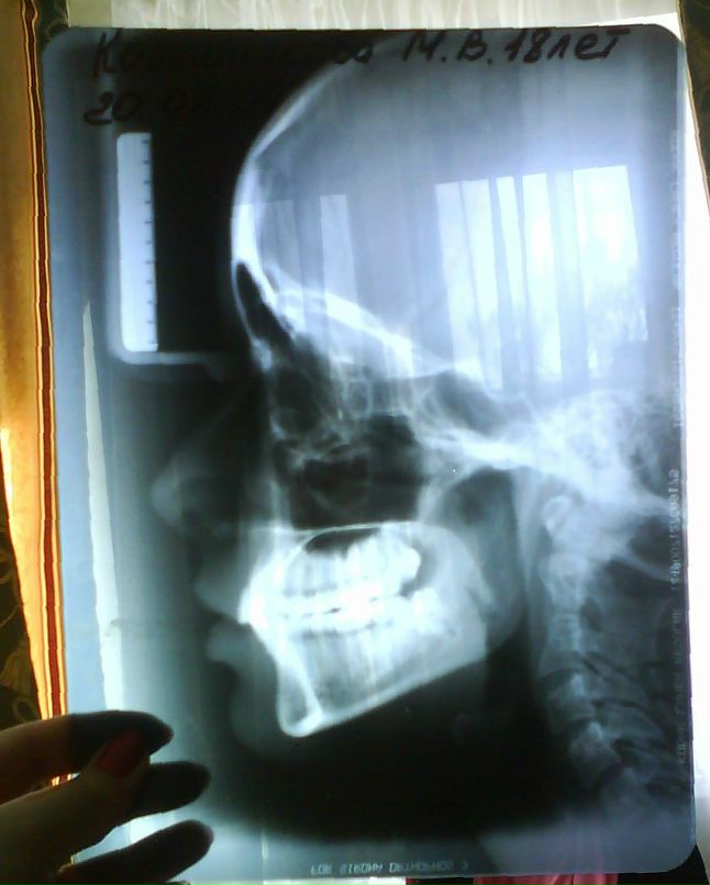 Марина Ускова | Долгопрудный