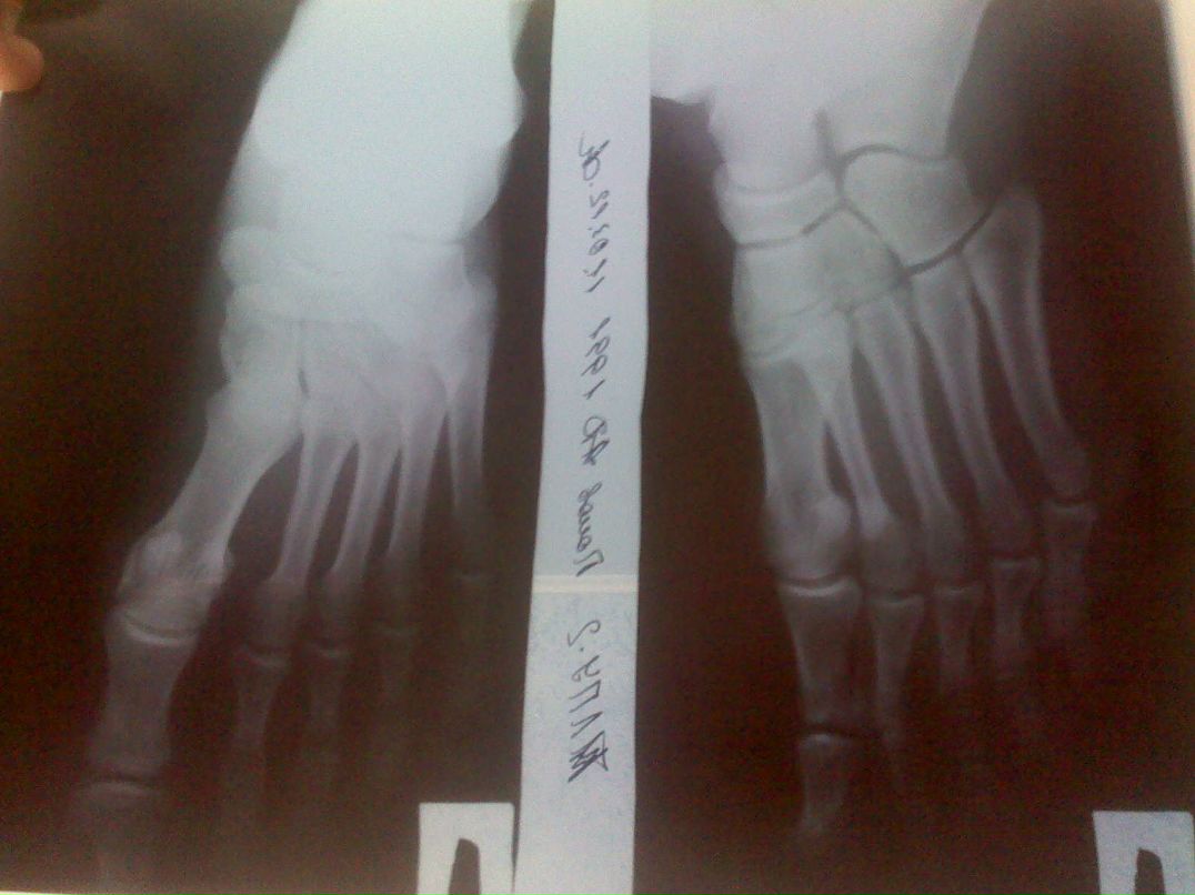 Александр Попов | Тамбов