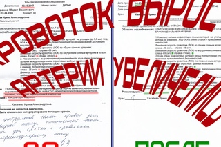 УЗДГ до и после Правки Атланта Гимранов М.В.